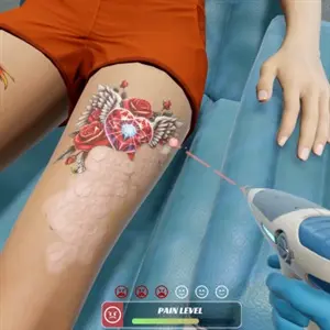 Tattoo Removal Simulator - Nível de dor